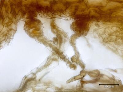 marchantia polymorpha ssp ruderalis archegonien quer