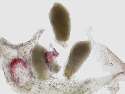 preissia quadrata ssp hyperborea antheridien quer