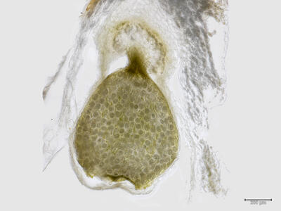 preissia quadrata ssp hyperborea weibliches koepfchen kapsel quer