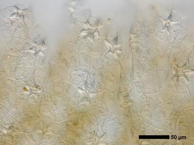 oxymitra incrassata 1 thallus atempore aufsicht