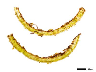 pedinophyllum interruptum 2 kapsel quer