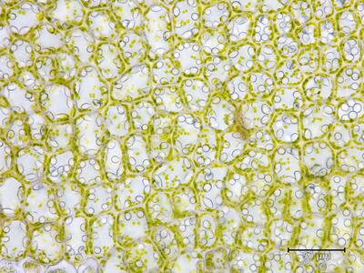 solenostoma sphaerocarpum flankenblatt blattbasis
