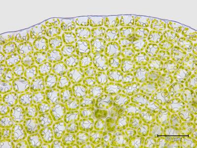 solenostoma sphaerocarpum flankenblatt blattspitze
