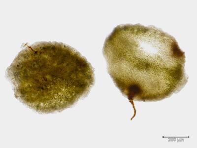 targionia hypophylla archegonien