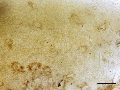 targionia hypophylla thallus atemporen aufsicht
