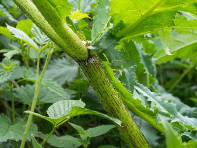 heracleum mantegazzianum haare